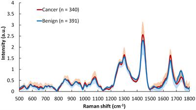 Improving skin cancer detection by Raman spectroscopy using convolutional neural networks and data augmentation